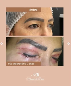 Dra Monise - Procedimentos (18)