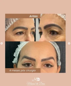 Dra Monise - Procedimentos (19)